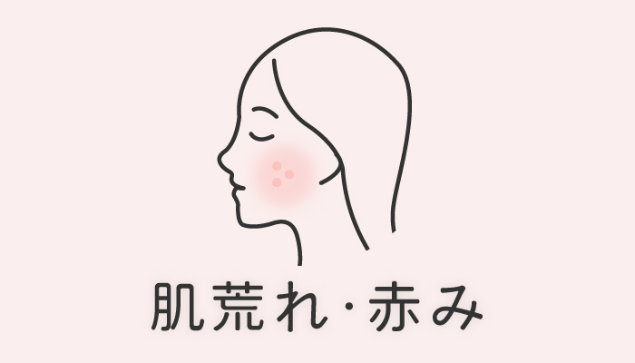 肌荒れ 